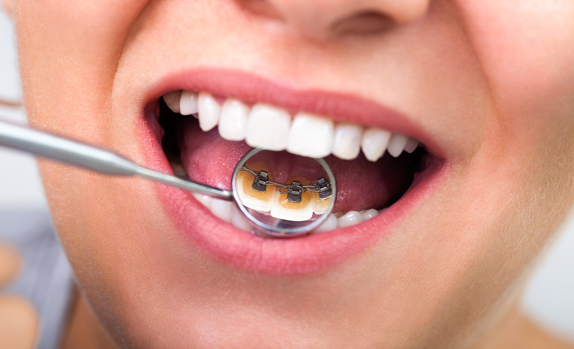 Fotolia_56438494_L.jpg
